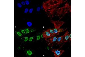 Immunocytochemistry/Immunofluorescence analysis using Mouse Anti-Cav3. (CACNA1G 抗体  (AA 2052-2172) (FITC))