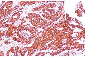 Immunohistochemistry (Paraffin-embedded Sections) (IHC (p)) image for anti-Spectrin alpha Chain, Brain (SPTAN1) antibody (ABIN7234066)