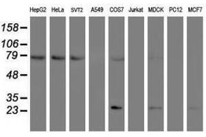 Image no. 1 for anti-Folate Hydrolase (Prostate-Specific Membrane Antigen) 1 (FOLH1) antibody (ABIN1500455) (PSMA 抗体)