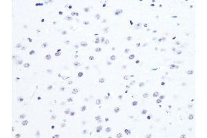 Immunohistochemistry of paraffin-embedded mouse brain using L Rabbit mAb (ABIN7270266) at dilution of 1:100 (40x lens). (ASH2L 抗体)