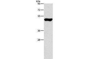 Western Blot analysis of Mouse pancreas tissue using ILK Polyclonal Antibody at dilution of 1:550 (ILK 抗体)