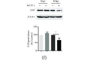 The effects of BoHV-1 infection on the gene expression of antioxidant enzymes. (Catalase 抗体  (AA 1-225))