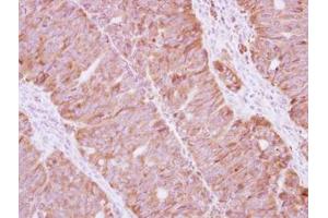 Image no. 1 for anti-Staufen Double-Stranded RNA Binding Protein 1 (STAU1) (AA 86-308) antibody (ABIN1501204) (STAU1/Staufen 抗体  (AA 86-308))