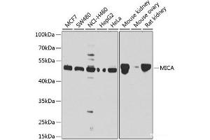 Western blot analysis of extracts of various cell lines using MICA Polyclonal Antibody at dilution of 1:1000. (MICA 抗体)