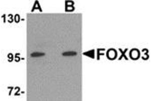 Western blot analysis of FOXO3 in A-20 cell lysate with FOXO3 antibody at (A) 0. (FOXO3 抗体  (N-Term))