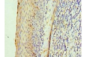 Immunohistochemistry of paraffin-embedded human tonsil tissue using ABIN7142595 at dilution of 1:100 (ALAS2 抗体  (AA 50-320))