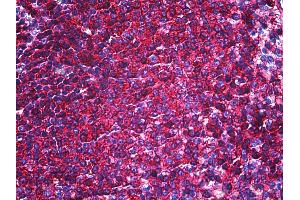 Anti-CD44 antibody IHC of human spleen. (CD44 抗体)