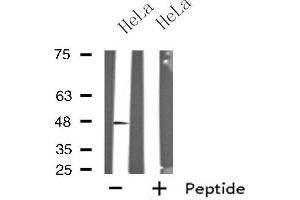 Western blot analysis of extracts from HeLa cells, using GPR19 antibody. (GPR19 抗体  (C-Term))