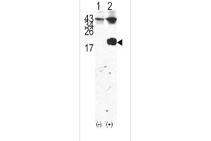 Western blot analysis of FKBP12 (arrow) using rabbit polyclonal FKBP12 Antibody (Center) (ABIN392172 and ABIN2841886). (FKBP1A 抗体  (AA 43-74))
