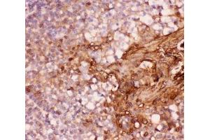 IHC-P: Annexin A1 antibody testing of human tonsil tissue (Annexin a1 抗体  (AA 2-346))