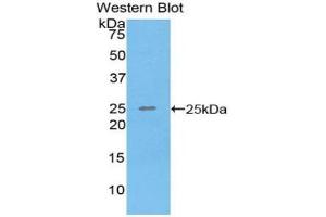 Western blot analysis of the recombinant protein. (SPRY3 抗体  (AA 91-288))