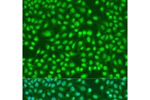 Immunofluorescence analysis of U2OS cells using PSEN2 Polyclonal Antibody at dilution of 1:100. (Presenilin 2 抗体)