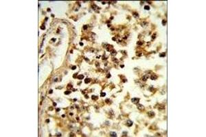 Formalin-fixed and paraffin-embedded human testis tissue reacted with IL31 Antibody (N-term), which was peroxidase-conjugated to the secondary antibody, followed by DAB staining. (IL-31 抗体  (N-Term))