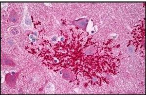 Human Brain, Astrocytes Microglia: Formalin-Fixed, Paraffin-Embedded (FFPE) (CXCR4 抗体  (C-Term))