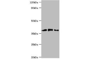 Western blot All lanes: Macrophage-capping protein antibody at 1 μg/mL Lane 1: Hela whole cell lysate Lane 2: NIH/3T3 whole cell lysate Lane 3: Rat lung tissue Secondary Goat polyclonal to rabbit IgG at 1/10000 dilution Predicted band size: 39, 37 kDa Observed band size: 39 kDa (CAPG 抗体  (AA 1-348))