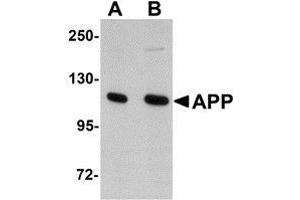 Western blot analysis of APP in rat brain tissue lysate with AP30073PU-N APP antibody at (A) 1 and (B) 2 μg/ml.