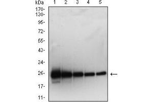 Western blot analysis using SARS-Cov2-NP2 mAb against human SARS-Cov2-N (AA: 120-300) recombinant protein. (SARS-Cov2-NP2 (AA 120-300) 抗体)