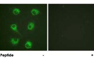 Immunofluorescence analysis of HUVEC cells, using CRKL polyclonal antibody . (CrkL 抗体)