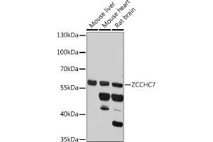 Western blot analysis of extracts of various cell lines, using ZCCHC7 antibody (ABIN7271547) at 1:1000 dilution. (ZCCHC7 抗体)