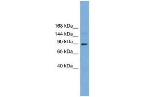 WB Suggested Anti-TTC27 Antibody Titration: 0. (TTC27 抗体  (N-Term))
