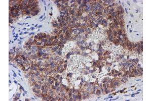 Image no. 5 for anti-Chromosome 21 Open Reading Frame 56 (C21orf56) antibody (ABIN1497041) (C21ORF56 抗体)