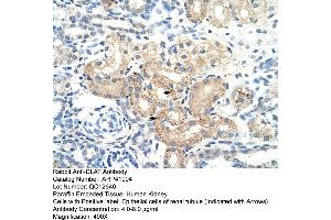 Rabbit Anti-DLAT Antibody  Paraffin Embedded Tissue: Human Kidney Cellular Data: Epithelial cells of renal tubule Antibody Concentration: 4.