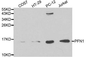 Western blot analysis of extracts of various cell lines, using PFN1 antibody. (PFN1 抗体  (AA 1-140))
