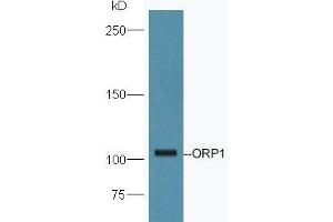 Mouse brain lysates probed with Anti-ORP1 Polyclonal Antibody, Unconjugated (ABIN2178099) at 1:300 in 4˚C. (OSBPL1A 抗体  (AA 851-950))