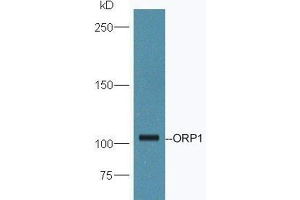 OSBPL1A 抗体  (AA 851-950)
