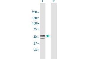 Western Blot analysis of BLMH expression in transfected 293T cell line by BLMH MaxPab polyclonal antibody. (BLMH 抗体  (AA 1-455))