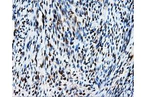 Immunohistochemical staining of paraffin-embedded Kidney tissue using anti-MCL1 mouse monoclonal antibody. (MCL-1 抗体)