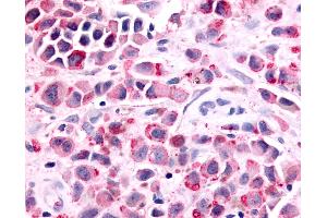 Immunohistochemistry (IHC) image for anti-Prostaglandin E Receptor 1 (Subtype EP1), 42kDa (PTGER1) (Cytoplasmic Domain) antibody (ABIN1049253)
