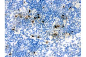 IHC analysis of Lipocalin 2 using anti-Lipocalin 2 antibody .