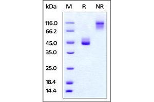 SDS-PAGE (SDS) image for T Cell Immunoreceptor with Ig and ITIM Domains (TIGIT) (AA 89-208) (Active) protein (Fc Tag) (ABIN4949062)