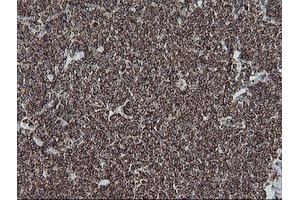 Image no. 2 for anti-NADH Dehydrogenase (Ubiquinone) 1 beta Subcomplex, 10, 22kDa (NDUFB10) antibody (ABIN1499669) (NDUFB10 抗体)