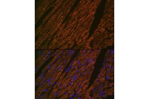 Immunofluorescence analysis of rat heart using Desmin Rabbit mAb (ABIN1678733, ABIN3018020, ABIN3018021 and ABIN7101569) at dilution of 1:100 (40x lens). (Desmin 抗体)