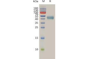 Human S Protein, hFc Tag on SDS-PAGE under reducing condition.