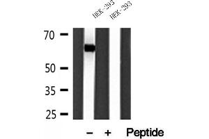 Western blot analysis of extracts of HEK-293 cells, using Sestrin 2 antibody. (Sestrin 2 抗体)