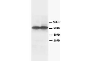 Western Blotting (WB) image for anti-Tyrosine Hydroxylase (TH) antibody (ABIN1109422) (Tyrosine Hydroxylase 抗体)