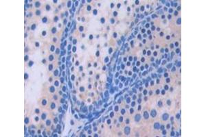 Used in DAB staining on fromalin fixed paraffin- embedded Kidney tissue (GGPS1 抗体  (AA 78-258))