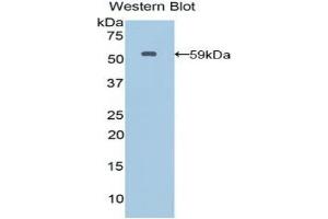 Detection of Recombinant MSN, Human using Polyclonal Antibody to Moesin (MSN) (Moesin 抗体  (AA 354-577))