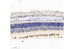 Immunohistochemistry (Paraffin-embedded Sections) (IHC (p)) image for anti-NAC alpha Domain Containing (NACAD) antibody (ABIN7074756)