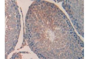 Detection of UCN in Rat Testis Tissue using Polyclonal Antibody to Urocortin (UCN) (Urocortin 抗体  (AA 31-121))