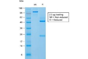 SDS-PAGE Analysis Purified Filaggrin Rabbit Recombinant Monoclonal Antibody (FLG/1957R). (Recombinant Filaggrin 抗体  (AA 198-288))