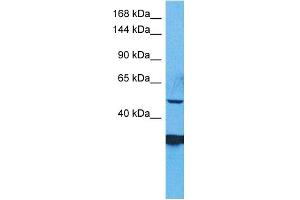 WB Suggested Anti-ZSC29 antibody Titration: 1 ug/mL Sample Type: Human RPMI-8226 Whole Cell (ZSCAN29 抗体  (Middle Region))