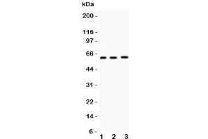 Western blot testing of FMO5 antibody and mouse samples (50ug/lane) 1: liver;  2: testis;  3: spleen tissue lysate. (FMO5 抗体  (N-Term))