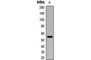 Western blot analysis of ALDH1A2 expression in MCF7 (A) whole cell lysates.