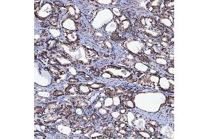 IHC analysis of SH2D4A using anti-SH2D4A antibody (ABIN7601695). (SH2D4A 抗体  (AA 42-454))