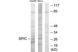 Western blot analysis of extracts from HepG2/HeLa cells, using SPIC Antibody. (SPIC 抗体  (AA 131-180))