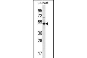 FA8A1 Antibody (N-term) (ABIN656718 and ABIN2845946) western blot analysis in Jurkat cell line lysates (35 μg/lane). (FAM8A1 抗体  (N-Term))